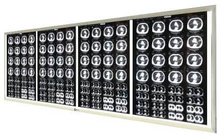 Quad-Panel X-Ray Film Viewer